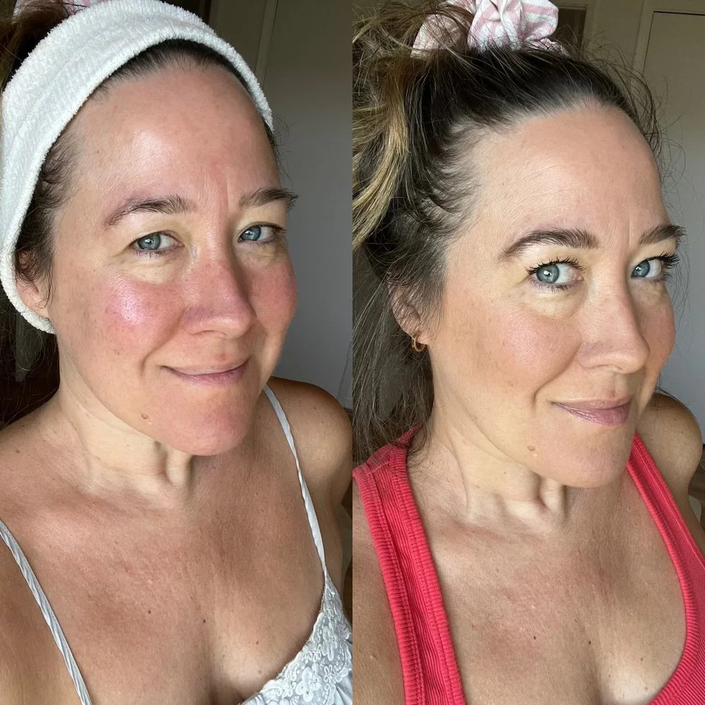 This Confusing Product Will Make Your Skin Look Better Than It's Ever Looked — The Candidly