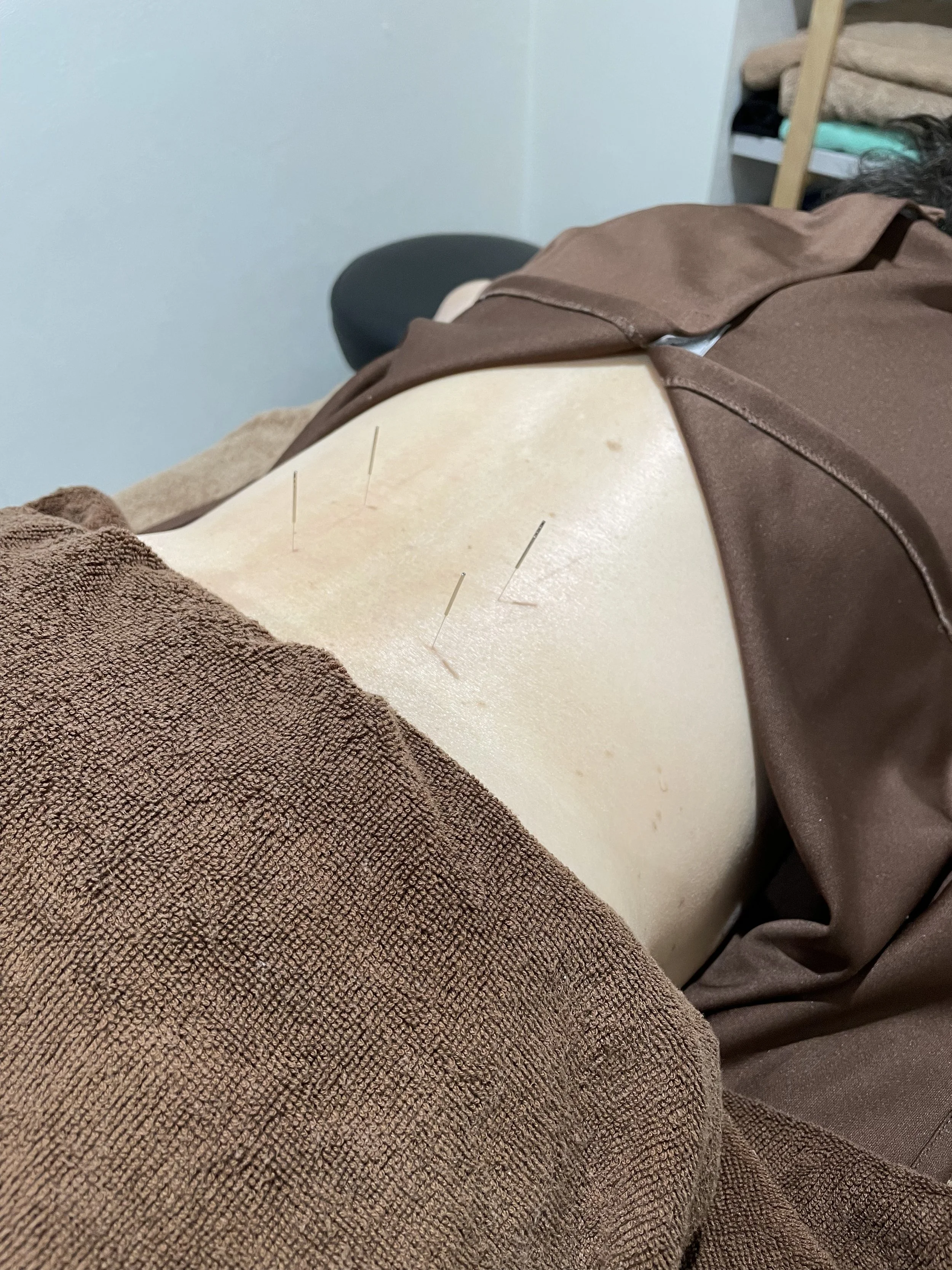 【症例】腰椎すべり症　６０代女性　水泳