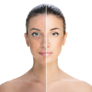 how to treat skin pigmentation problems