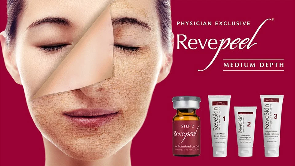 enlighten rx peel near me