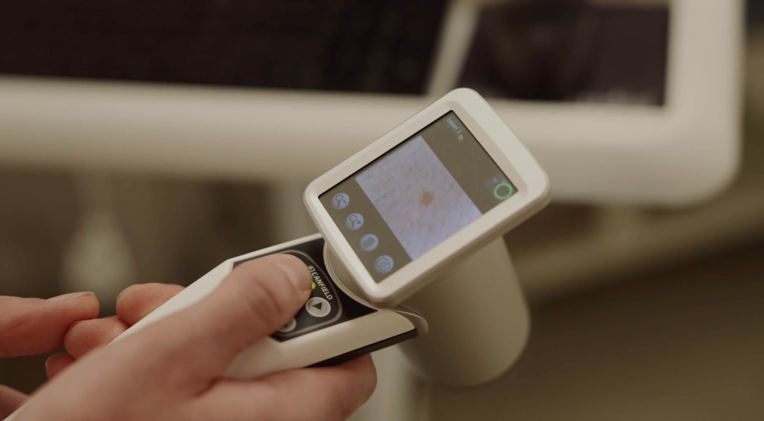 Skin Cancer Clinic & Mole Maps