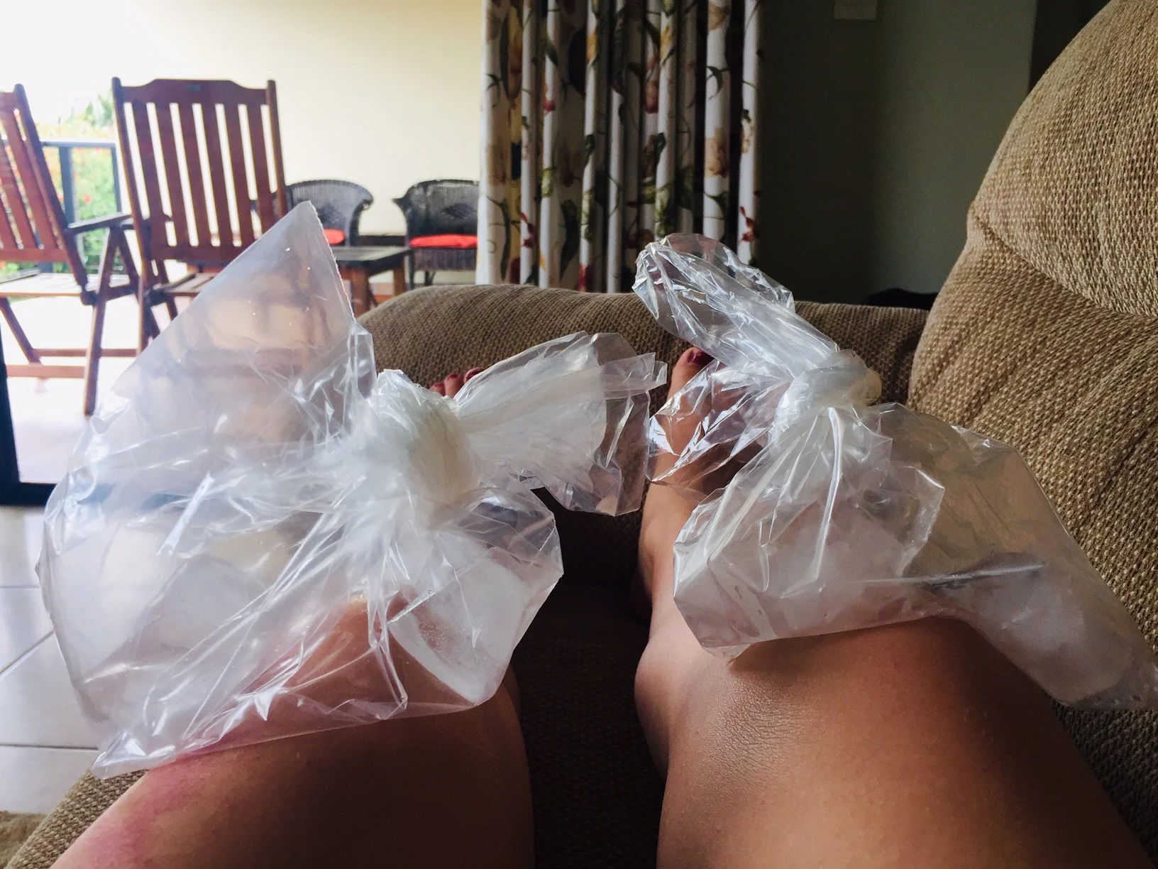 ice-knee-injury-running-mama-on-the-run-blog-sa.jpg