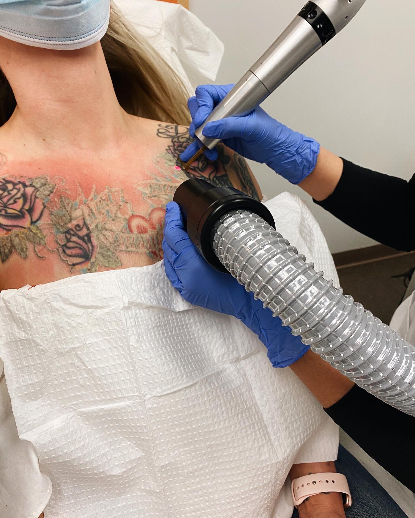 Today I started the long process of getting my chest tattoo removed. You can see it all in detail over on @danihampton- I just published a Reel and have a highlight up as well. I&rsquo;m excited to share because when I was looking for real life exper