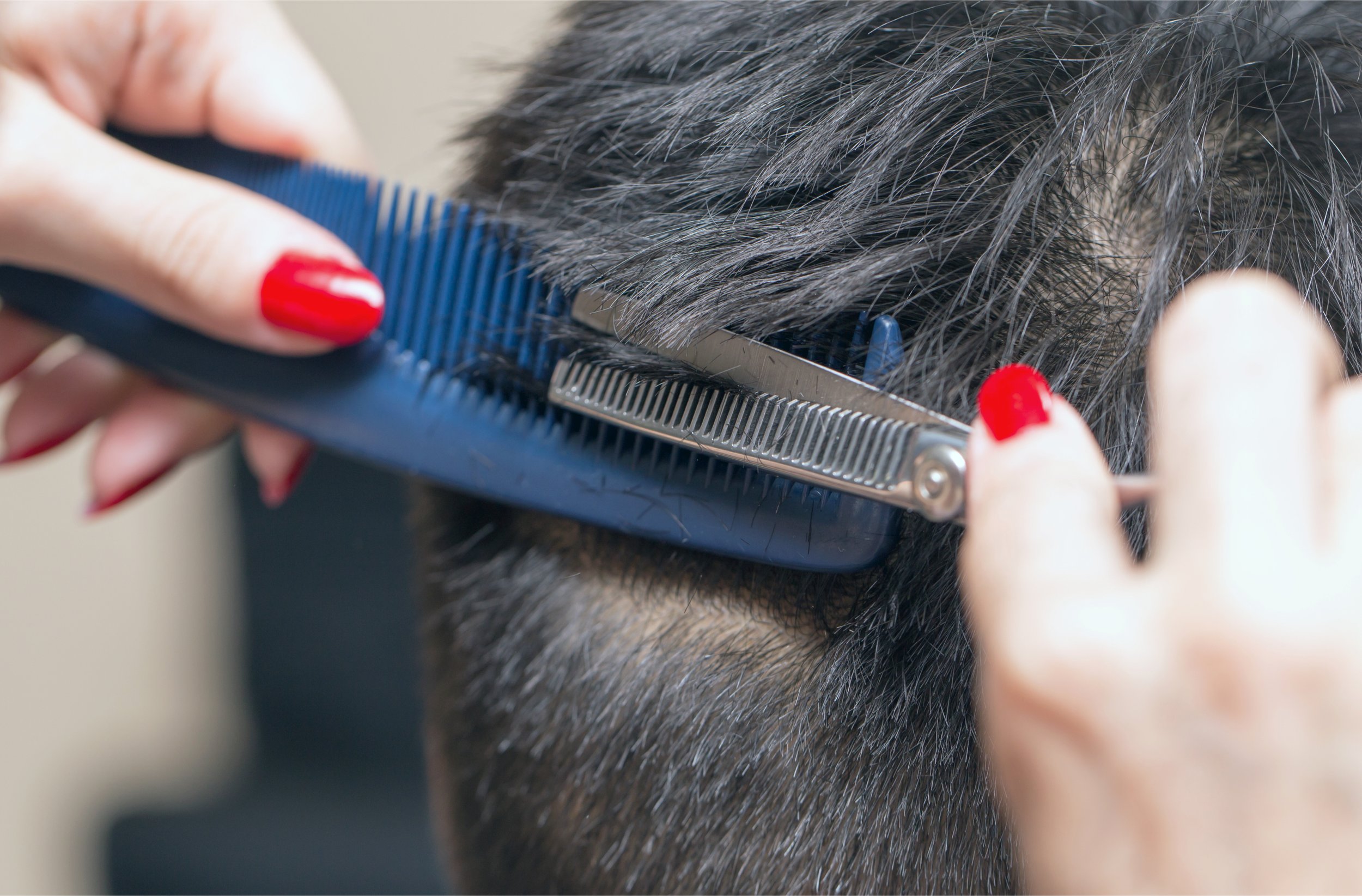 New York City's Hair Restoration-Best Hair Systems and Hair Replacement