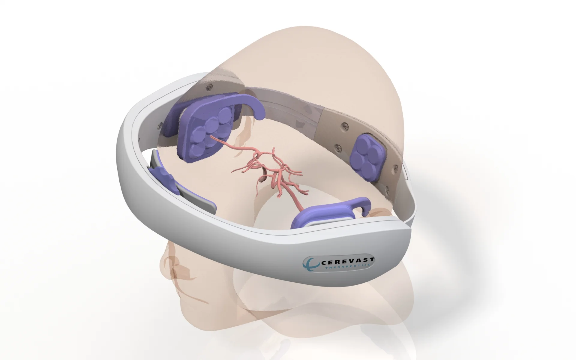 CER Unit with Head.JPG