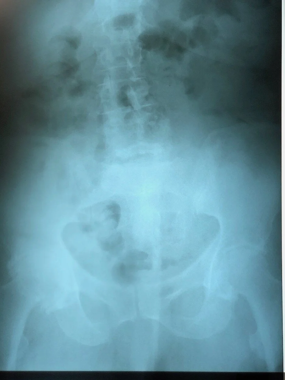 DAY 373: Weather Reflects My Mood