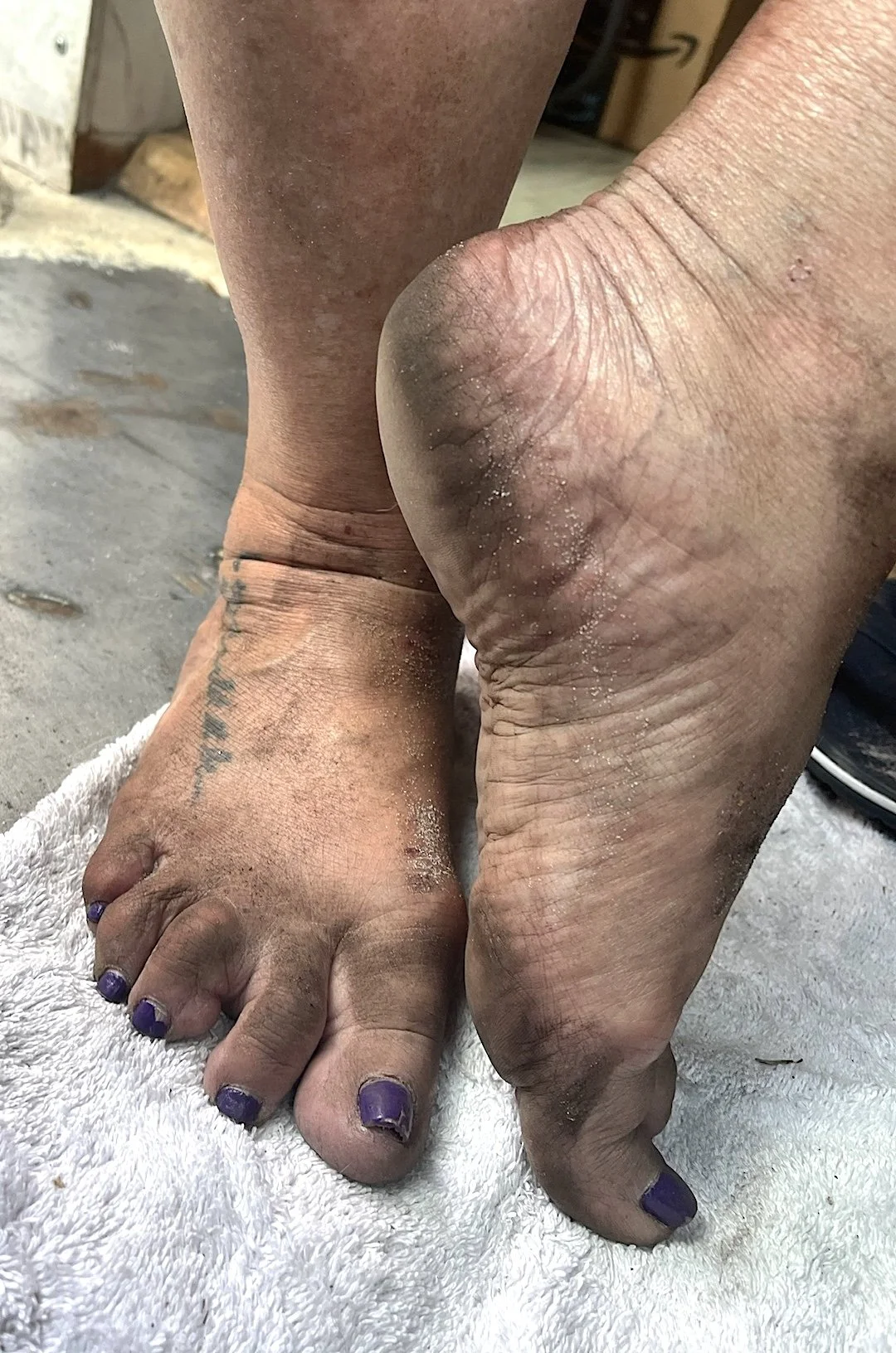 DAY 945: Dirty Hippie &amp; Decisions