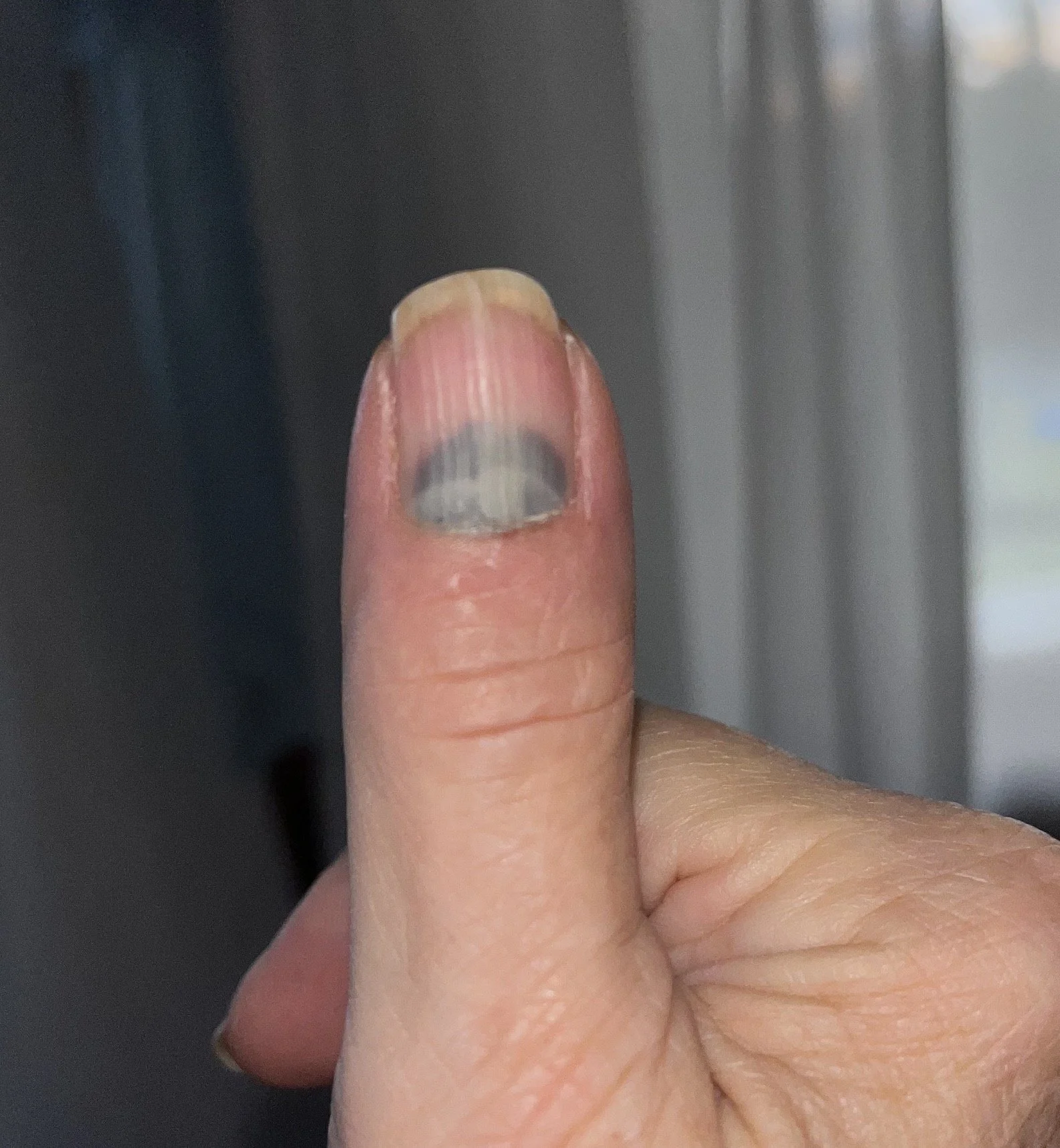 August 29: Pain and Pleasure