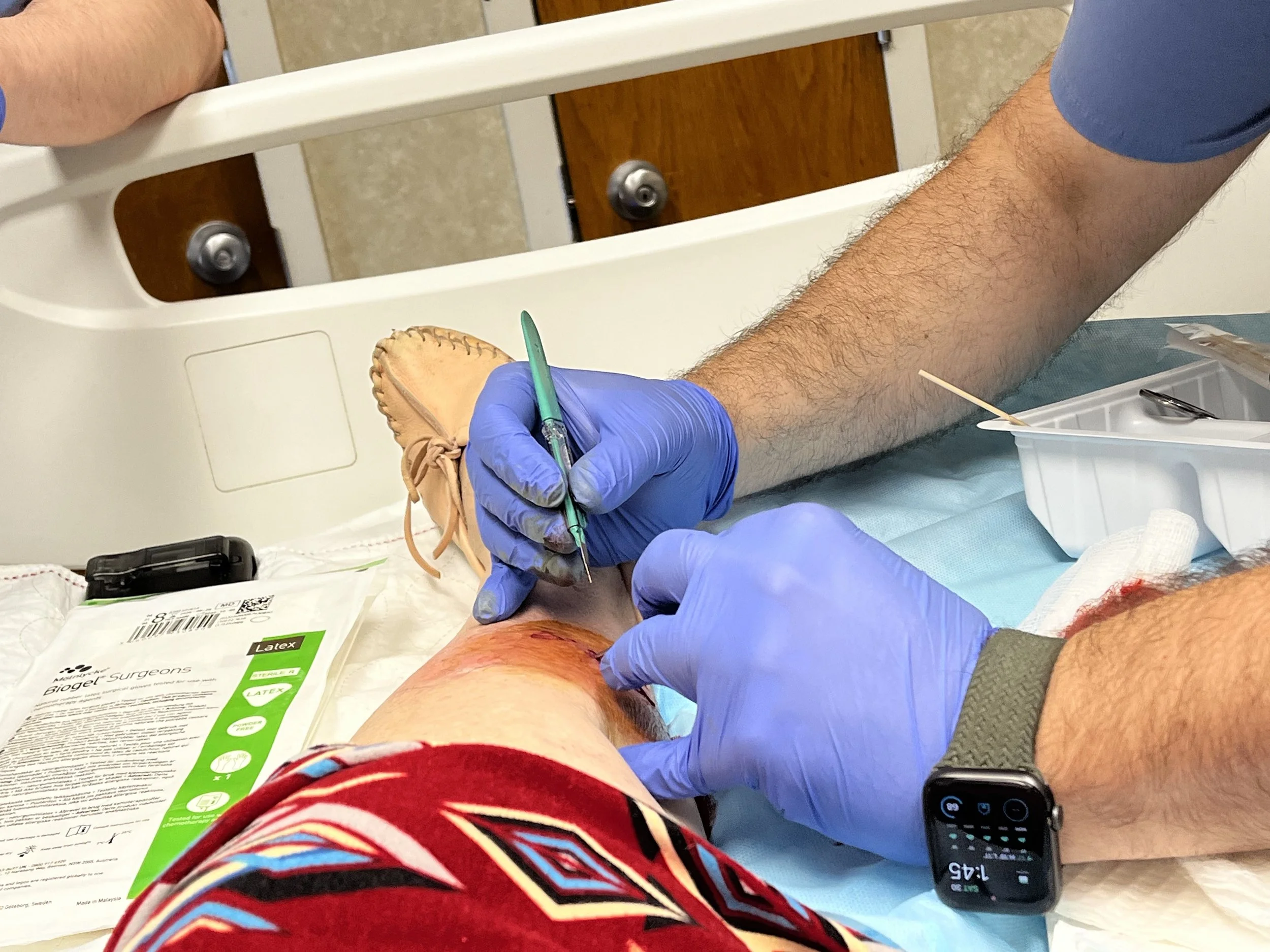 September 30: A Little Procedure 