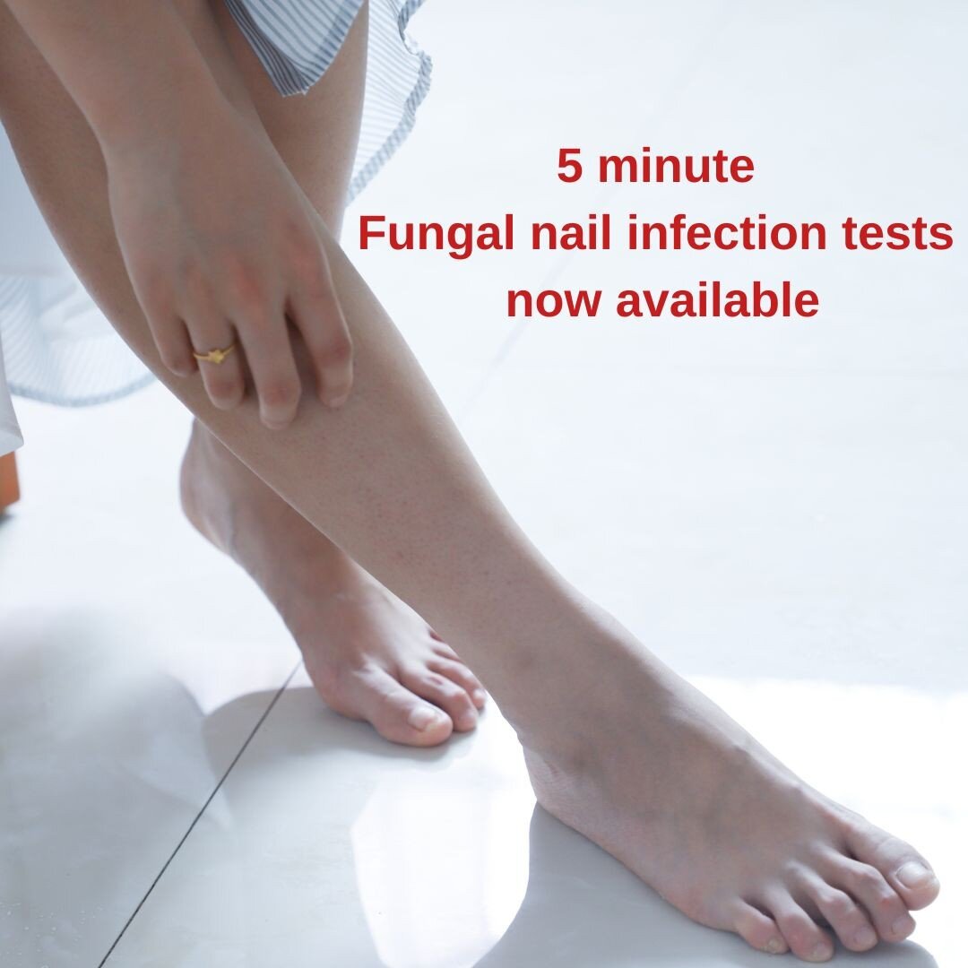 Think you may be suffering from a fungal nail infection? 

At Panakeia UK, we can test any nails of concern and give you results within 5 minutes with 97% accuracy. 

No more long surgery wait times or requests with the NHS GP

Book your appointment 