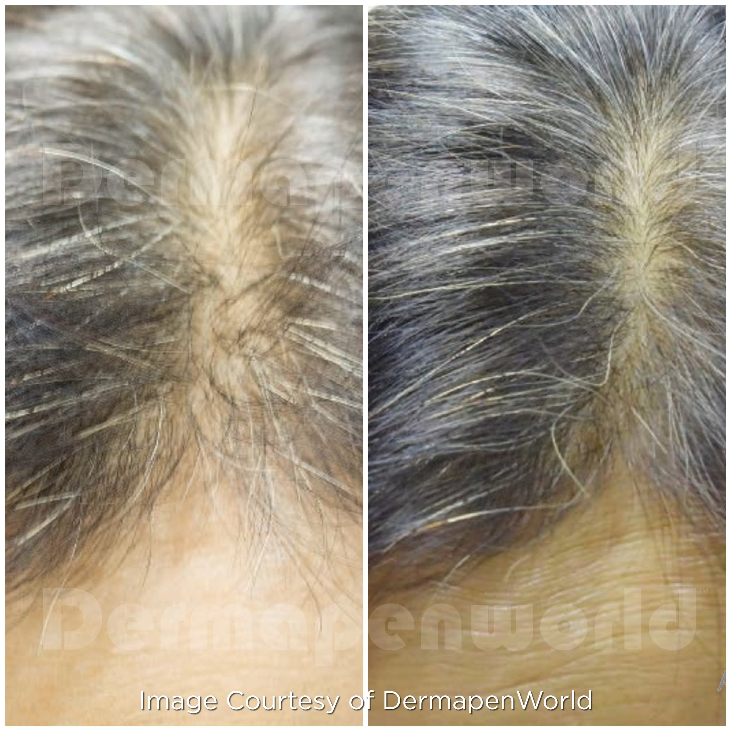 EXO_Client 113_Hair_Female.jpg