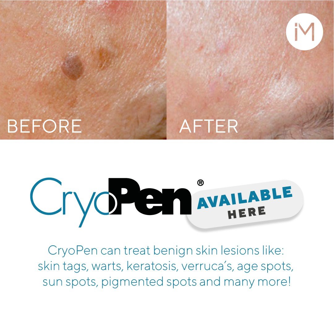 We are now offering Cryotherapy services at Panakeia (UK).
Have you got a skin imperfection you would like removing? 

Contact us today to see how we can remove these in as little as 1 minute. 

Telephone📞: 01234 910707
Email📧: info@panakeia-uk.com