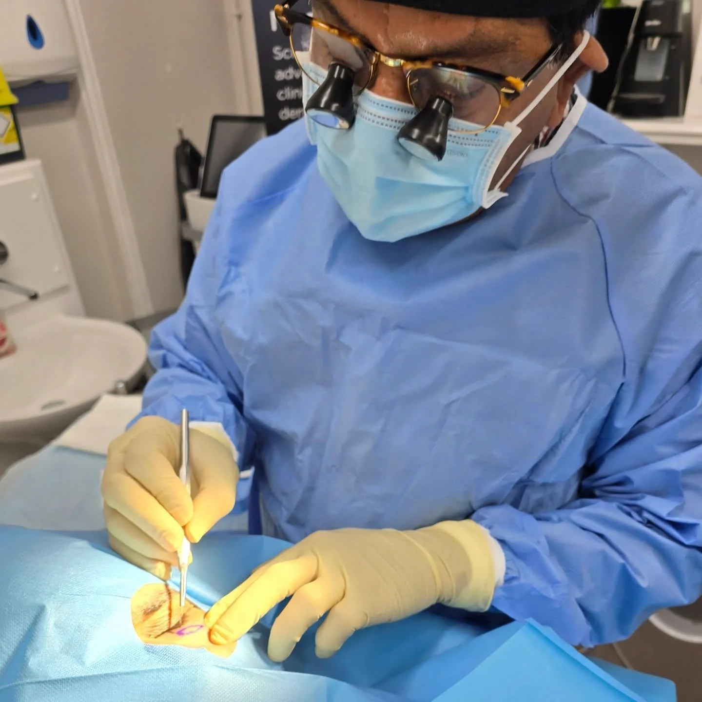 Our highly skilled consultant cosmetic plastic surgeon, Mr Javaid, in action!

Here, he was carefully and skilfully removing a xanthelasma lesion leaving the finest possible scar that would heal and blend in with the surrounding tissue over time.

If