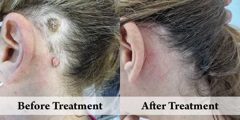 Minor Surgery-Before & After.png