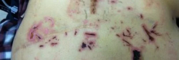 Mar 28, 2015 - Statement of Vern Traversie in wake of jury denying his claims‏