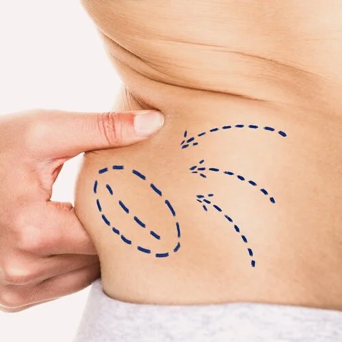 *New to Aberdeen* DESO Body & Deso Face Fat Dissolving Injections