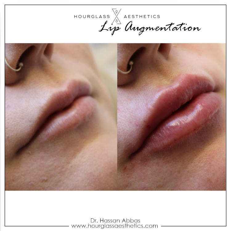 lips241119.png