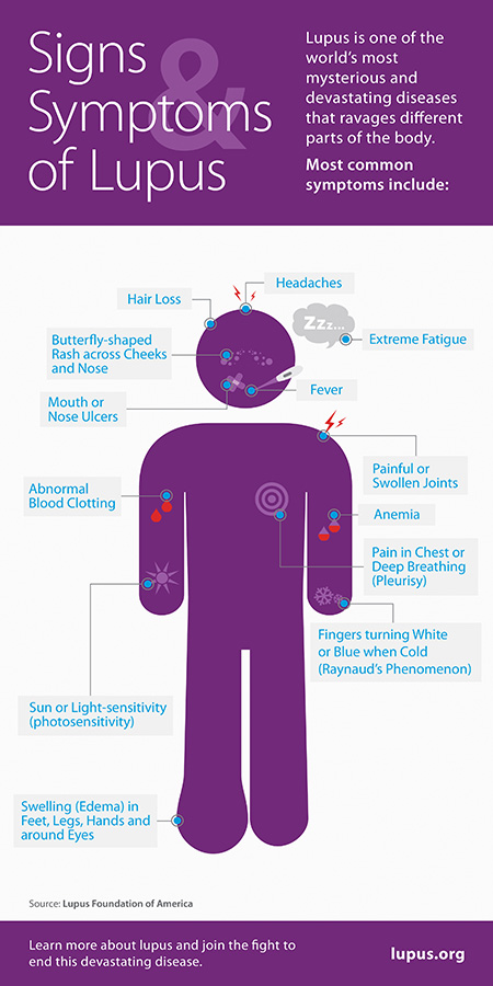 Lupus-Infograph2.jpg