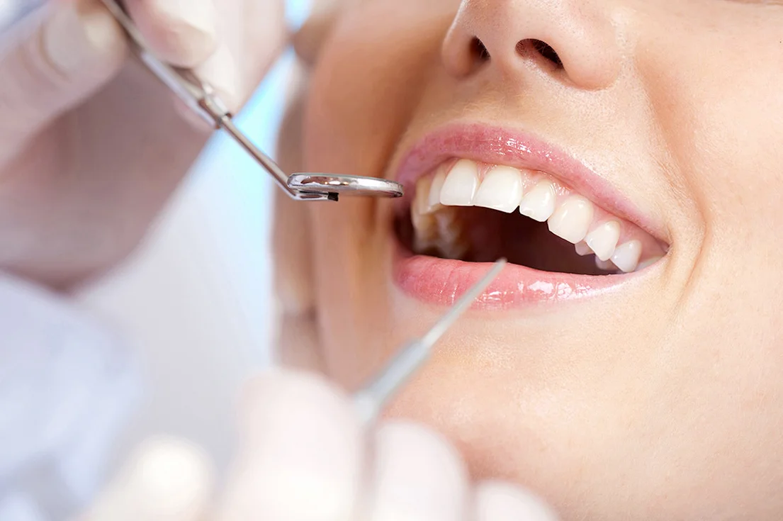 Full-Mouth-Cleaning.jpg
