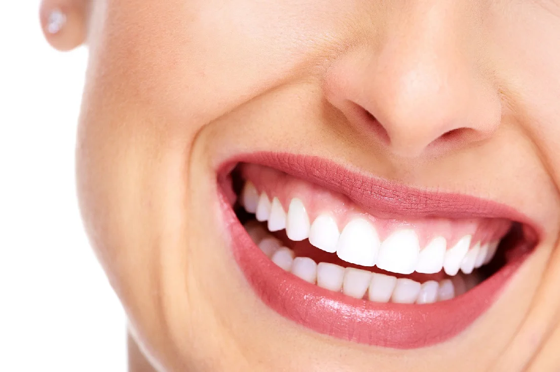 Natural-Teeth.jpg