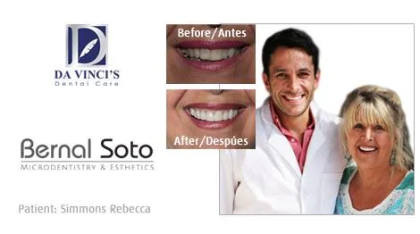 Dr soto before and after testimonial rebecca simmons.jpg