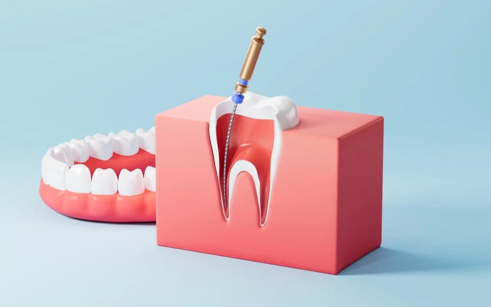 What Happens Inside a Tooth During a Root Canal Procedure?