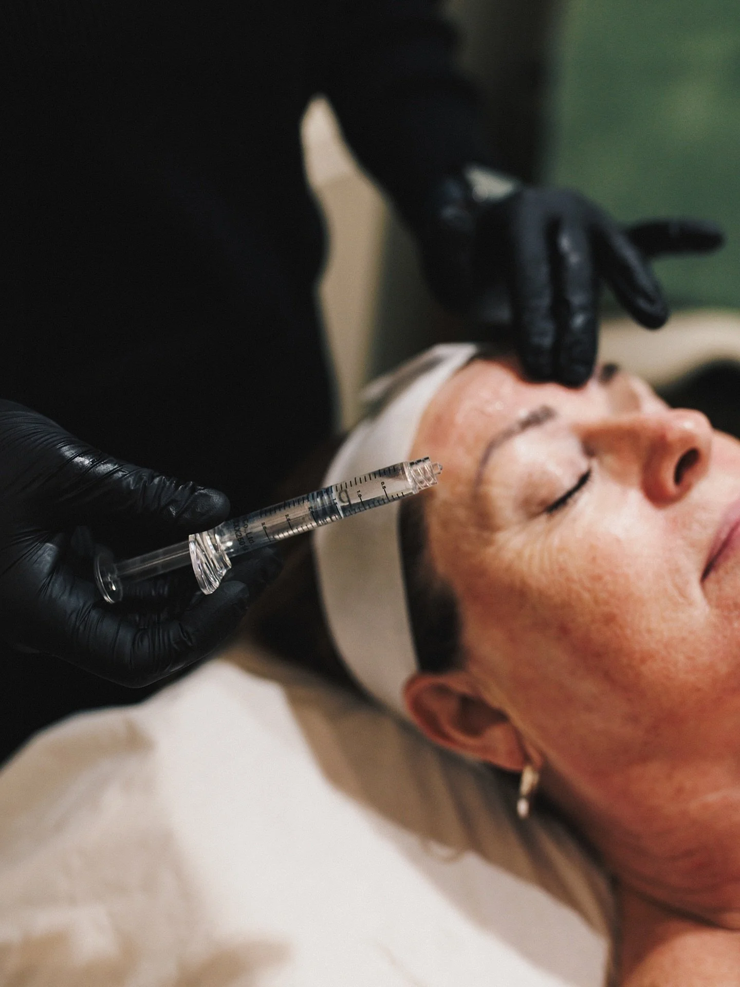 POLYNUCLEOTIDES 🐟

dna fragments, typically derived from purified salmon or trout. once introduced into the skin they:
&bull; act as a biostimulator, encouraging fibroblast activity
&bull; support collagen &amp; elastin synthesis
&bull; improve skin