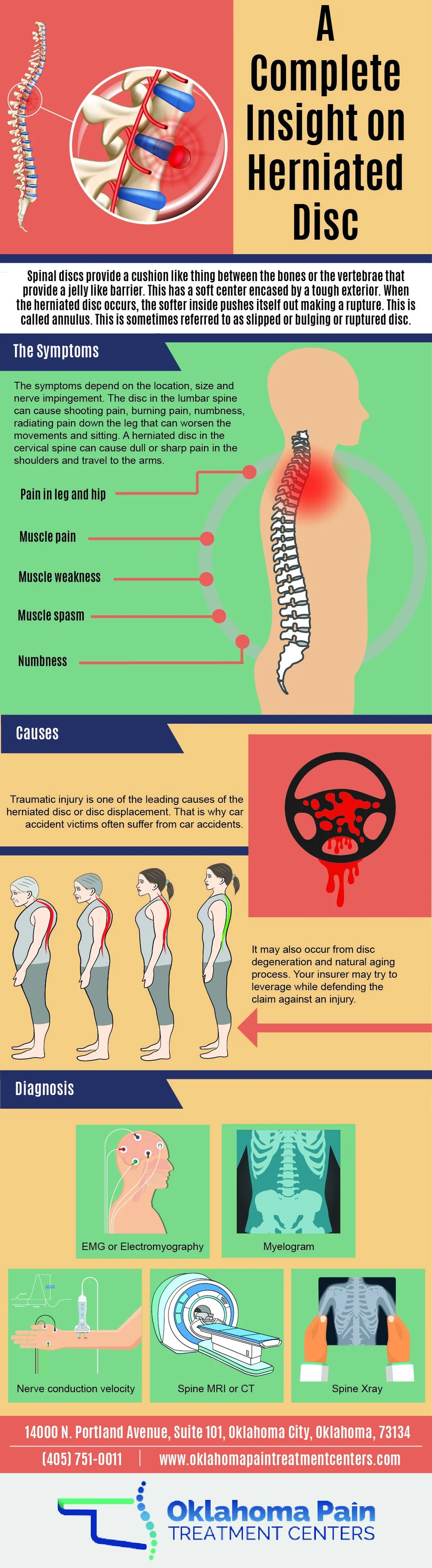 slipped disc vs muscle spasm Amy Abraham