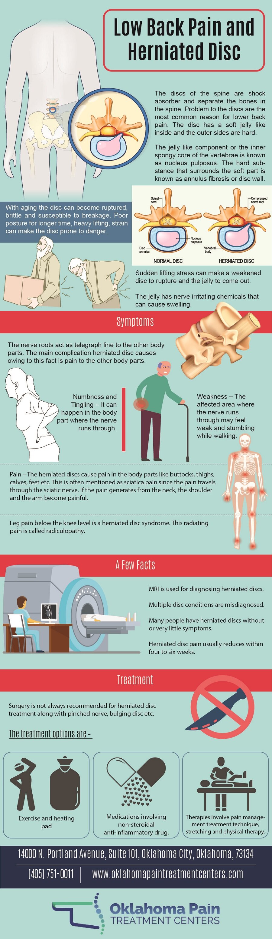 Low Back pain and Herniated Disc (Infographic)