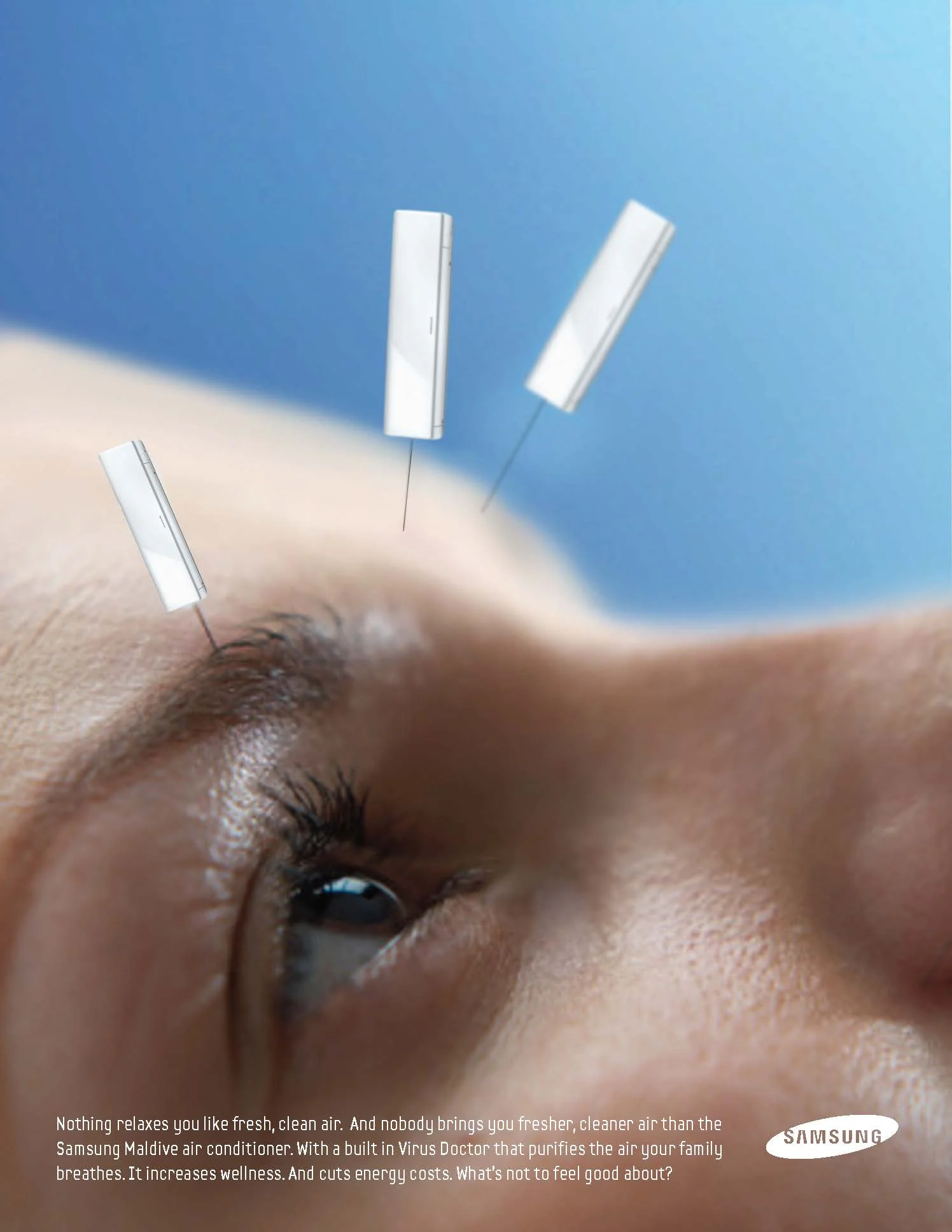 acupuncture.jpg