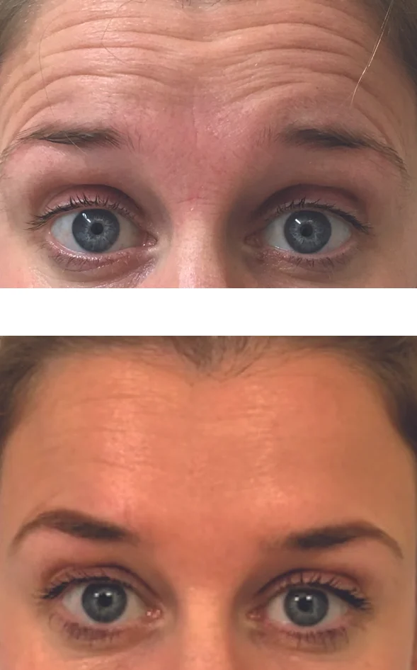 raising eyebrows