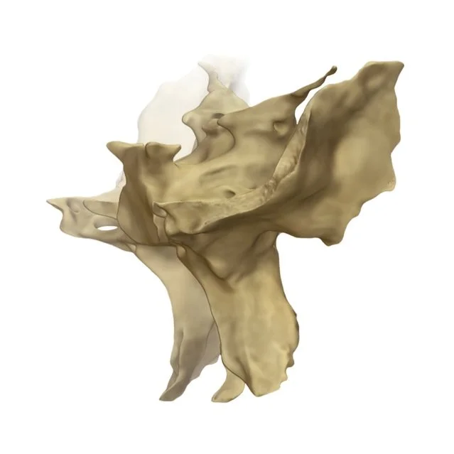 sphenoid-bone-views-final.jpg