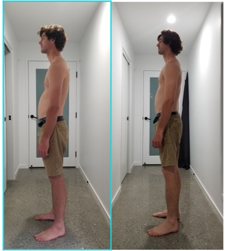 Lukas, 27 yo. Initial posture (left) 28.02.20  vs final (right) 29.05.2020