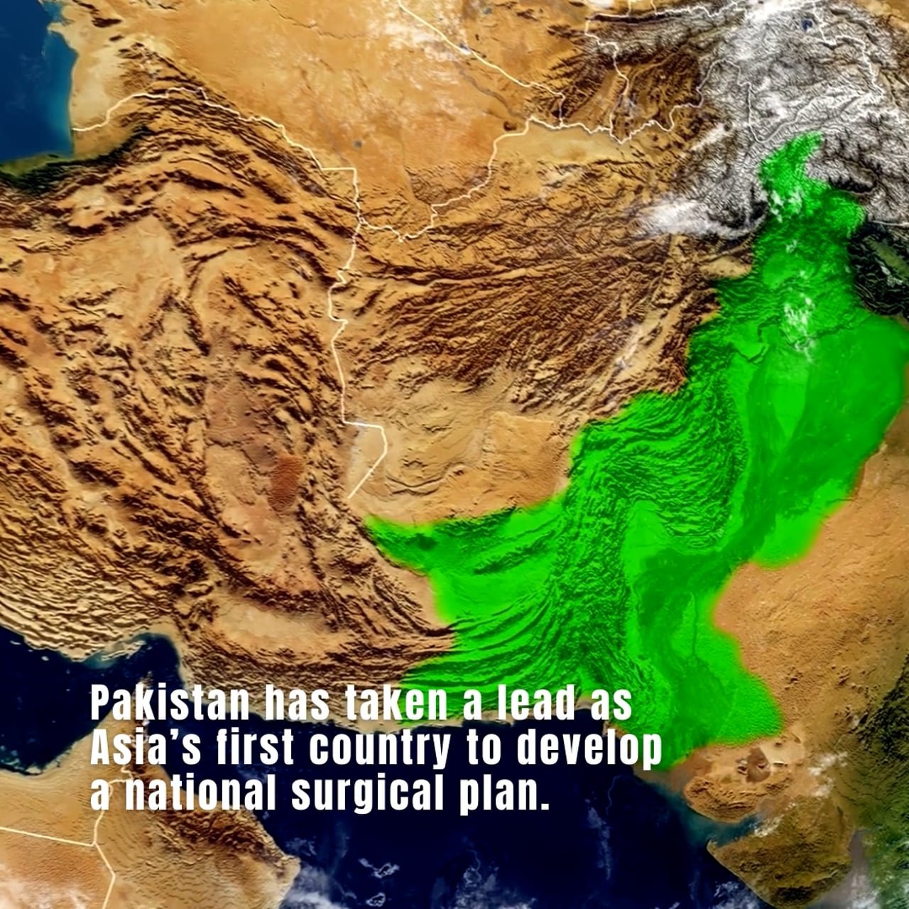 Watch: Pakistan Launches Its National Surgical Plan