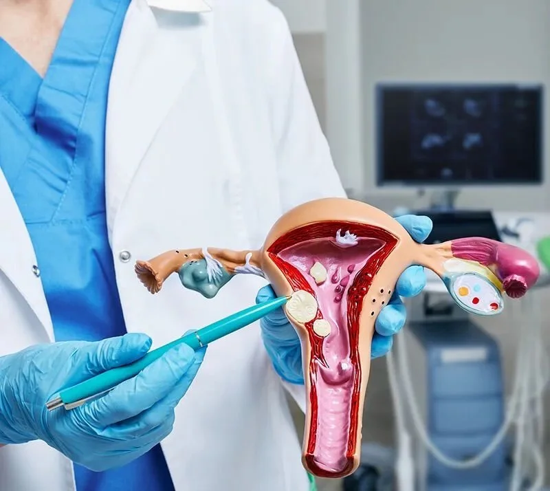 Black Women &amp; Fibroids: Take Back Control Through Diet