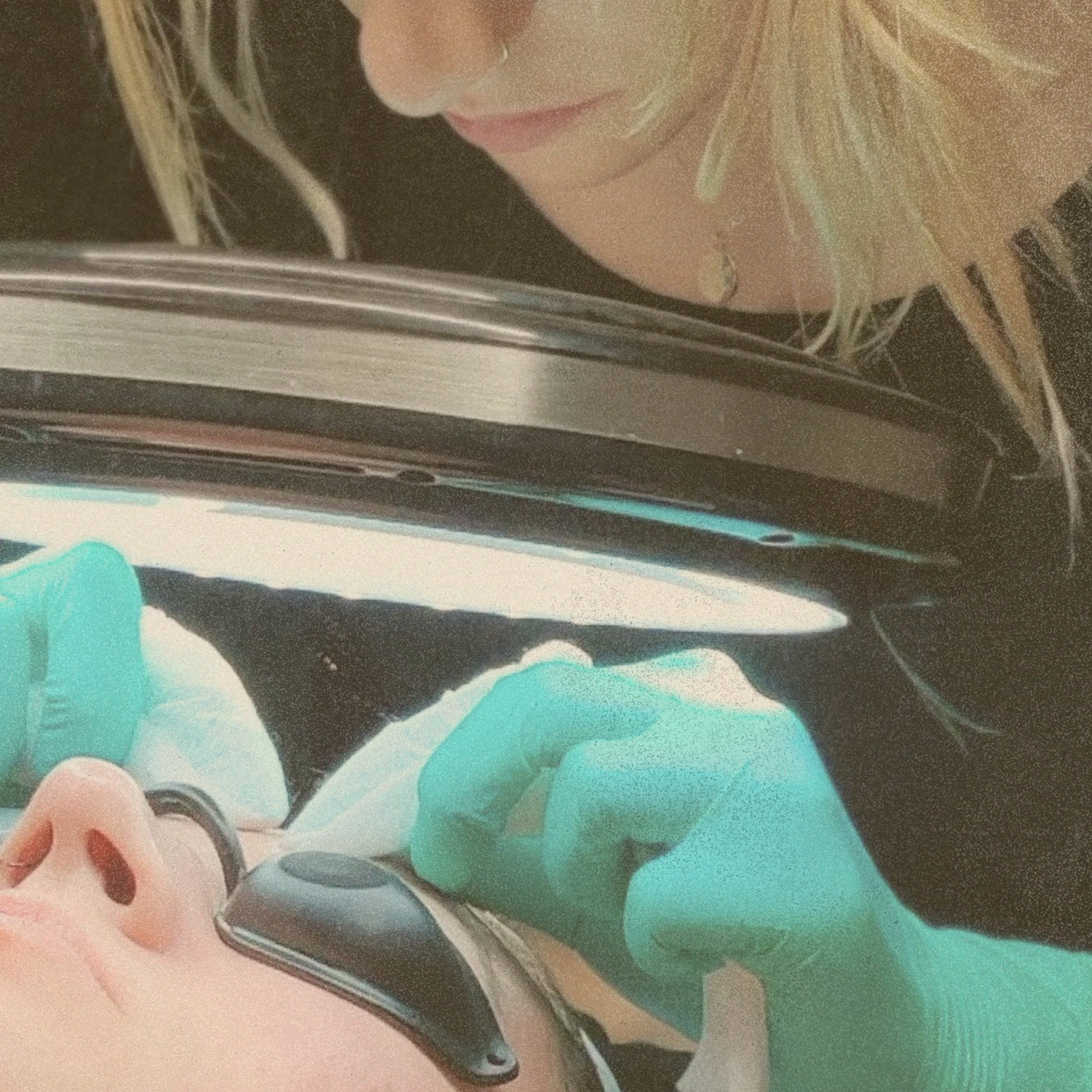 Picking Apart the Habit of Skin Picking