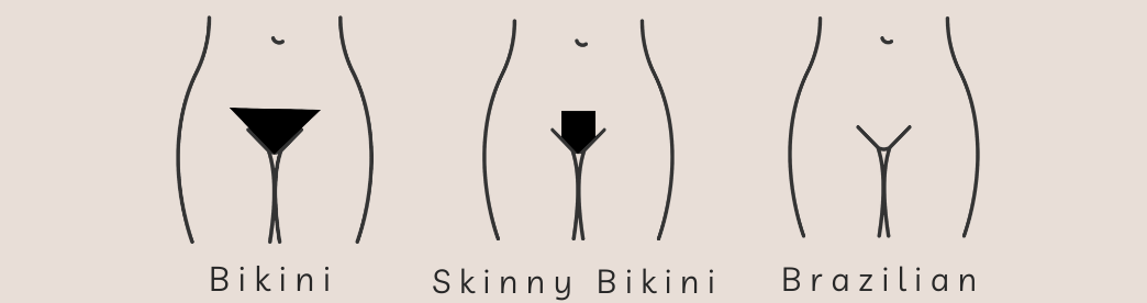 Illustration comparing bikini, skinny bikini, and Brazilian waxing styles for a client to choose from at V's Skin Studio