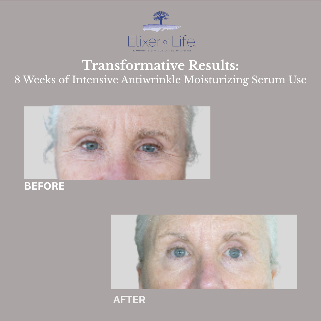 Before+and+After+(5) (1).webp (Copy) (Copy)