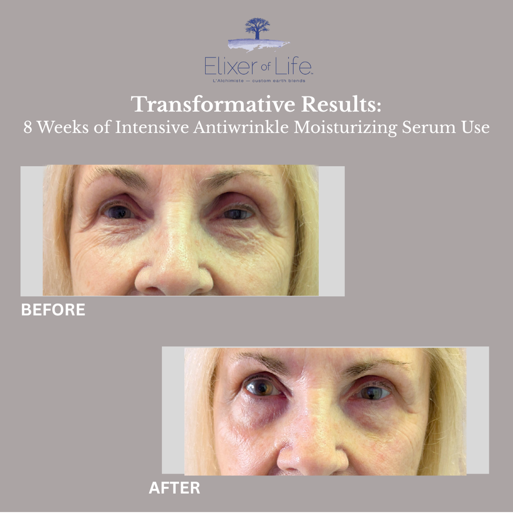 Before+and+After+(2) (1).webp