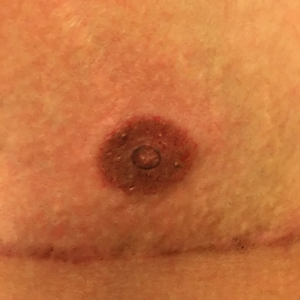 3D Nipple Tattoos | FTM Tattoo — FTM Tattoo