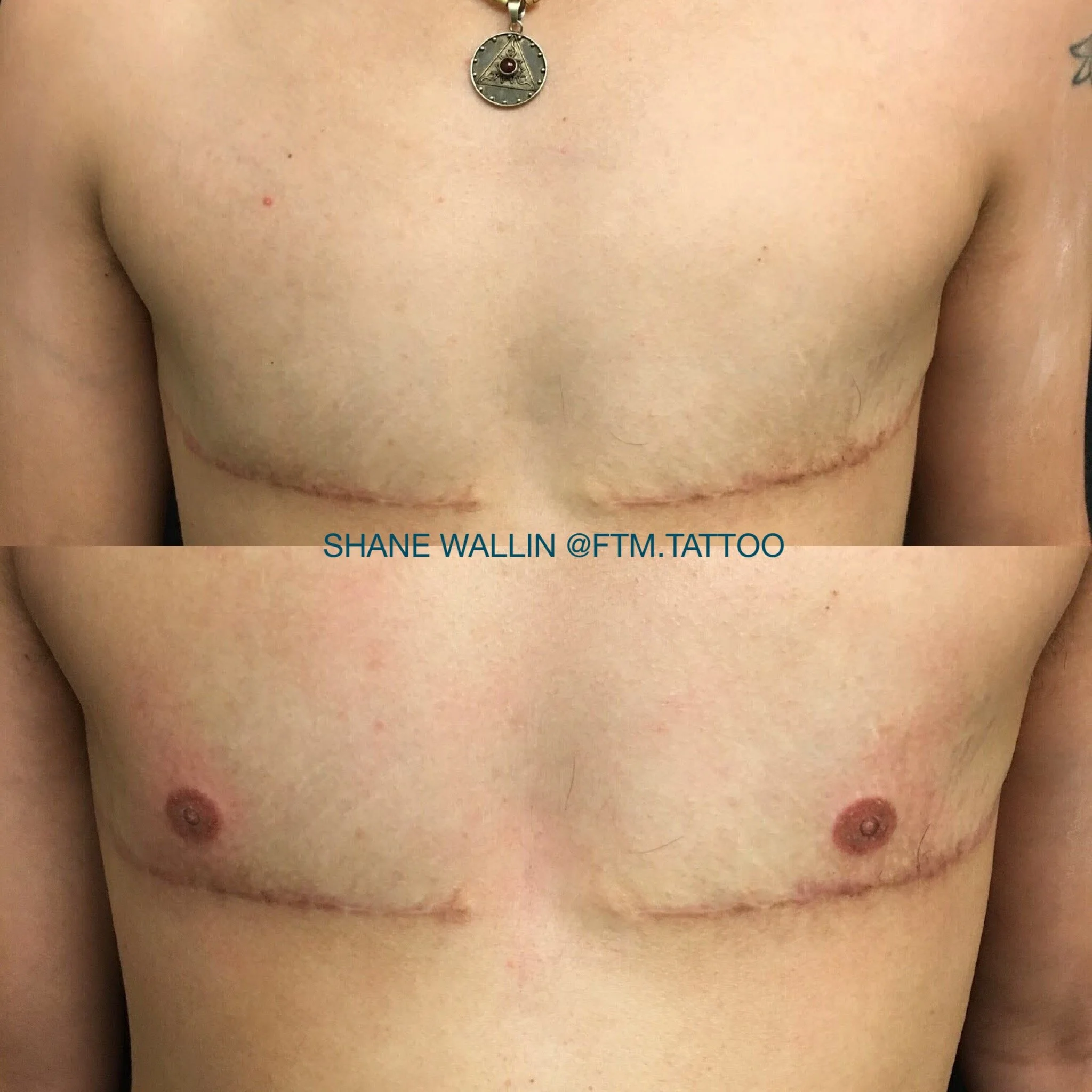 Tattooing Graft Free.jpg