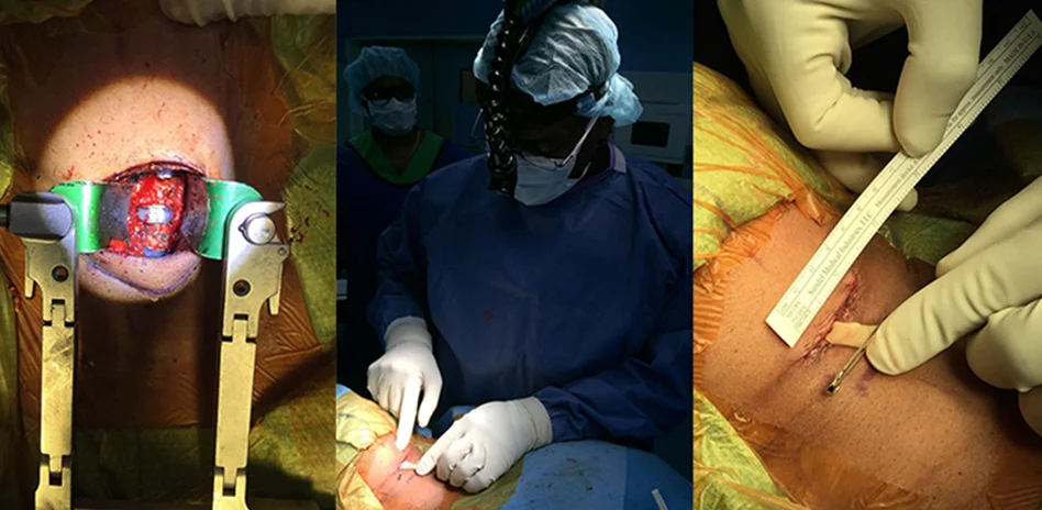 less-exposure-surgery.jpg