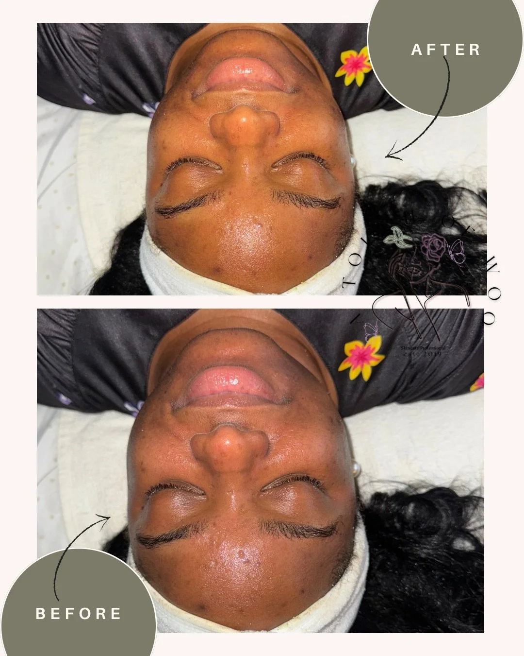 Before &amp; After

Come get this Natural Glow!!!

Schedule your self care service with me today!!

&bull;Facials
&bull;Waxing
&bull;Body Treatments
&bull;Salt Water Float 
&bull; Relaxation Room

Link in Bio 

www.atouchofwoo.com
8067 Branch Ave 
Cl