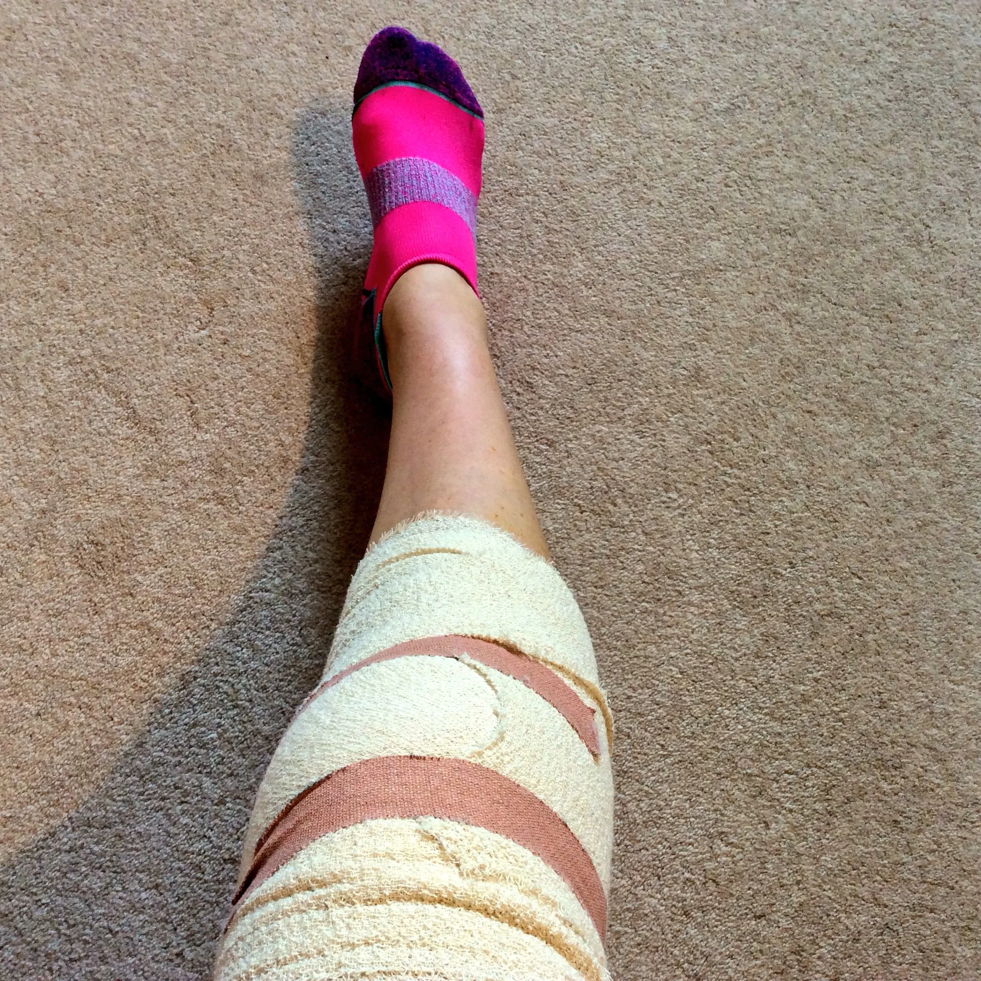 My right knee after surgery.