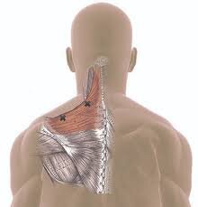 Trigger point in the upper back  Pain at the side of the neck