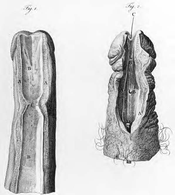 1796- Longtitudinal section of the Peins- John Hunter.jpg