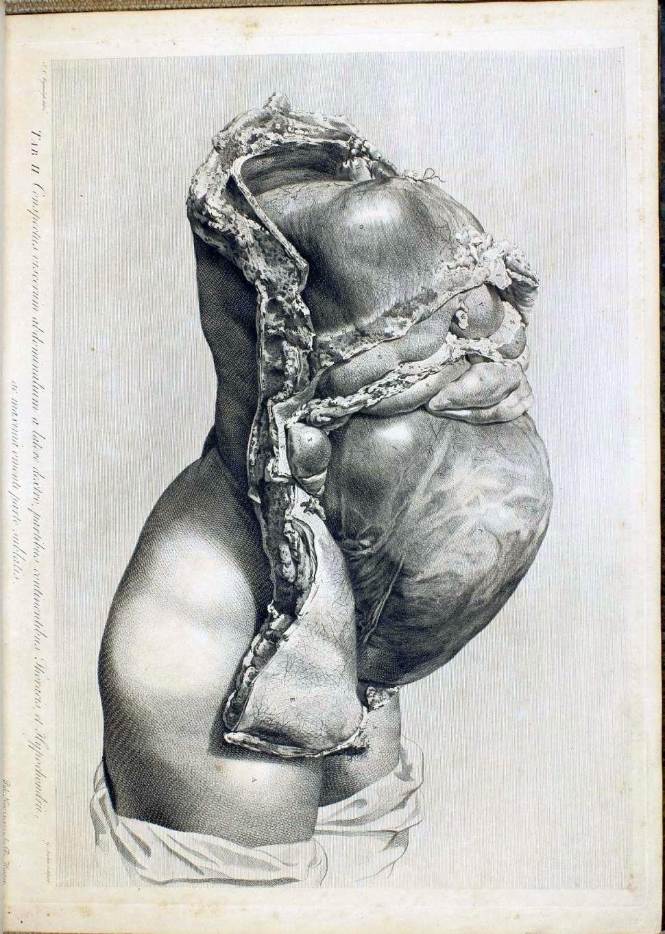 1774- Fetus in the Womb- William Hunter0.jpg