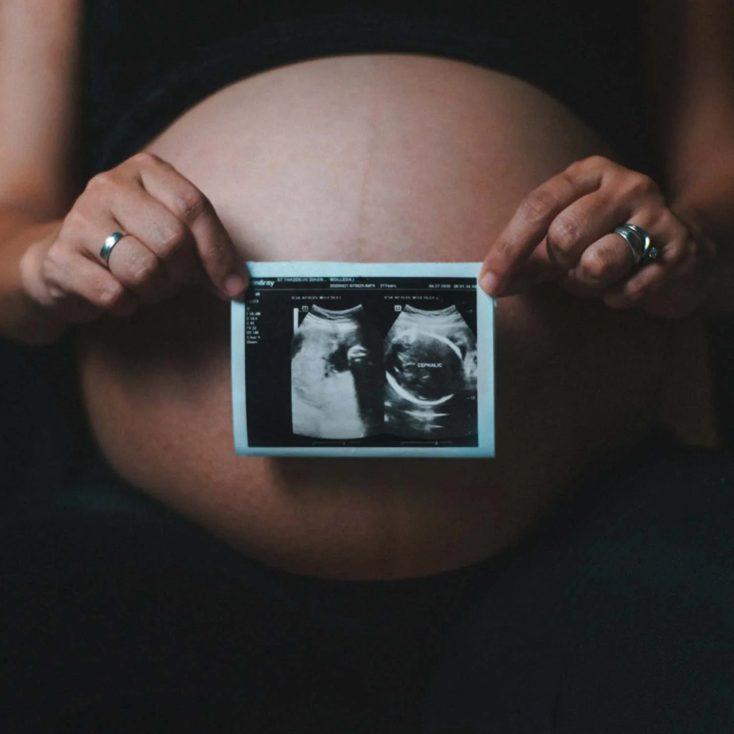 Holistic Childbirth Preparation at Mother&Child in Singapore