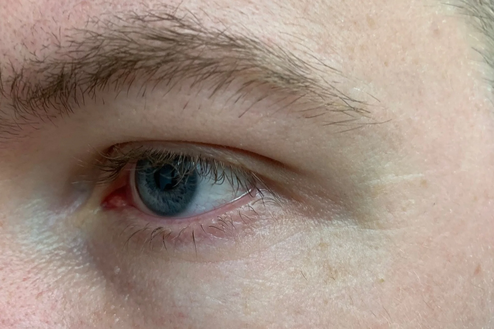 BEFORE (UNEDITED)