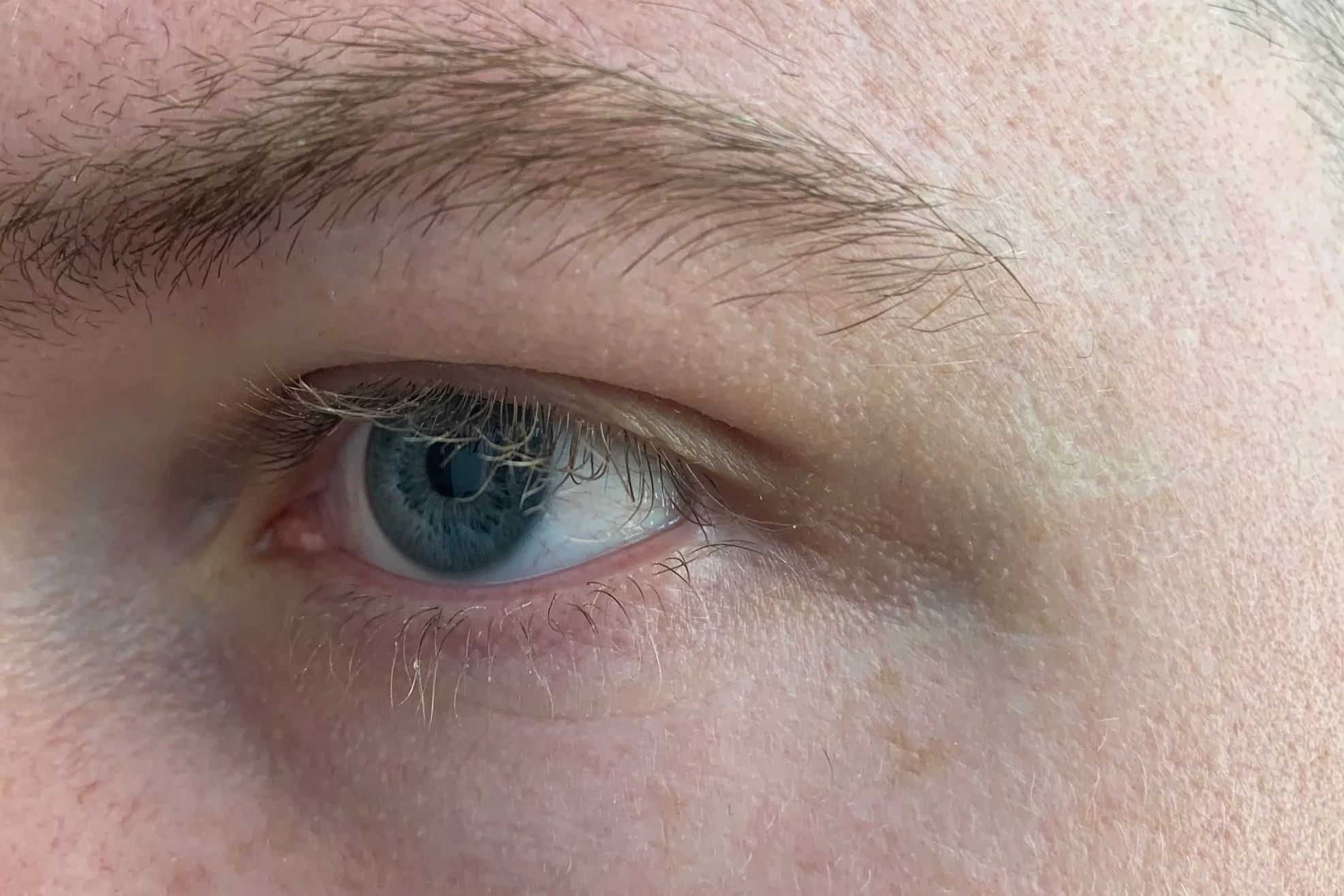 AFTER 2 MONTHS (UNEDITED)